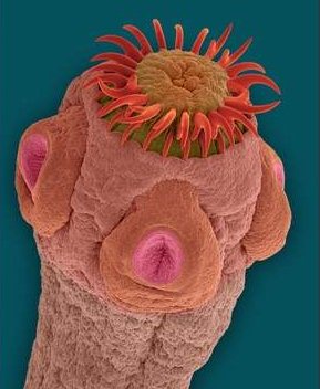 Свинной цепень кишечний червь вызывающий заболевание тениозом